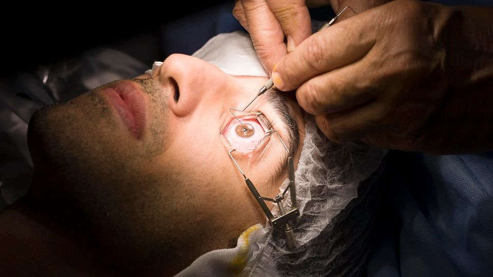 Can Glaucoma Be Fixed With Lasik Surgery