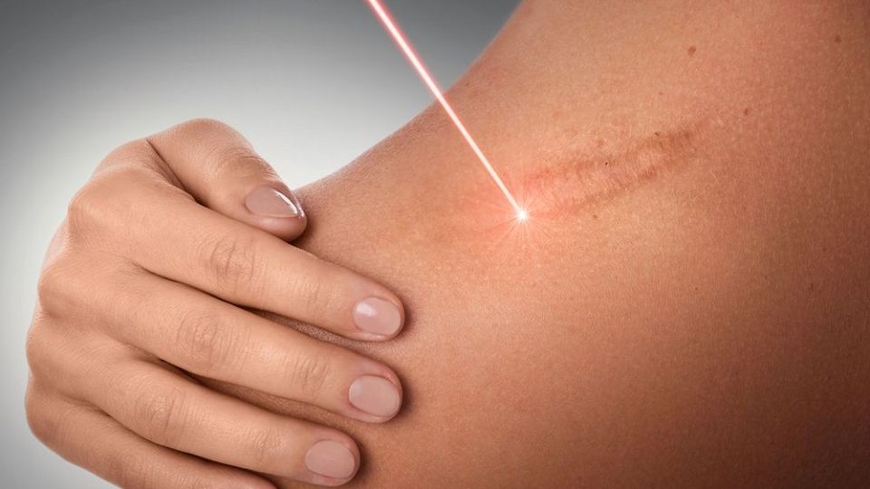 Using Medical And Aesthetic Lasers