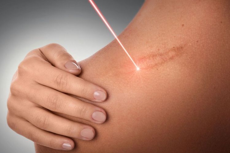 Using Medical And Aesthetic Lasers